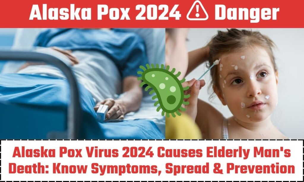 Alaska Pox Virus 2024 Causes Elderly Man's Death: Know Symptoms, Spread & Prevention